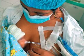 𝗛𝗼𝘀𝗽𝗶𝘁𝗮𝗹 𝗖𝗮𝗿𝗹𝗼𝘀 𝗟𝗮𝗻𝗳𝗿𝗮𝗻𝗰𝗼 𝗟𝗮 𝗛𝗼𝘇 𝗹𝗼𝗴𝗿𝗮 𝗽𝗿𝗼𝗲𝘇𝗮 𝗺é𝗱𝗶𝗰𝗮 𝗮𝘁𝗲𝗻𝗱𝗶𝗲𝗻𝗱𝗼 𝗮 𝗯𝗲𝗯é 𝗽𝗿𝗲𝗺𝗮𝘁𝘂𝗿𝗮 𝗱𝗲 690 𝗴𝗿𝗮𝗺𝗼𝘀 𝘁𝗿𝗮𝘀 𝗲𝘅𝗶𝘁𝗼𝘀𝗮 𝗶𝗻𝘁𝗲𝗿𝘃𝗲𝗻𝗰𝗶ó𝗻 𝗱𝗲 𝗲𝗺𝗲𝗿𝗴𝗲𝗻𝗰𝗶𝗮